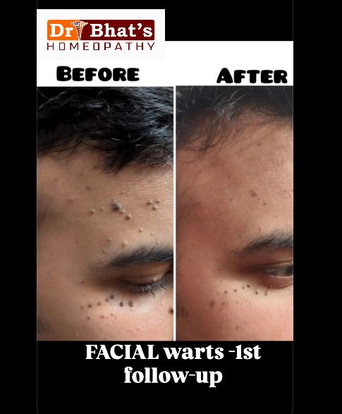 Why choose Dr. Bhat's Homeopathy - homeopathic clinic in Bengaluru with experienced doctors